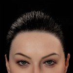 Implant Hair